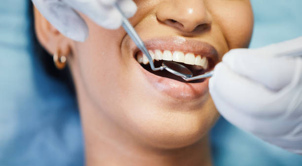 Best Tooth Infection Emergency Dentist  in Las Lomas, CA